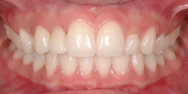 Case-5-After